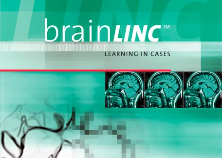 Biogen Idec | Publicación – BrainLinc