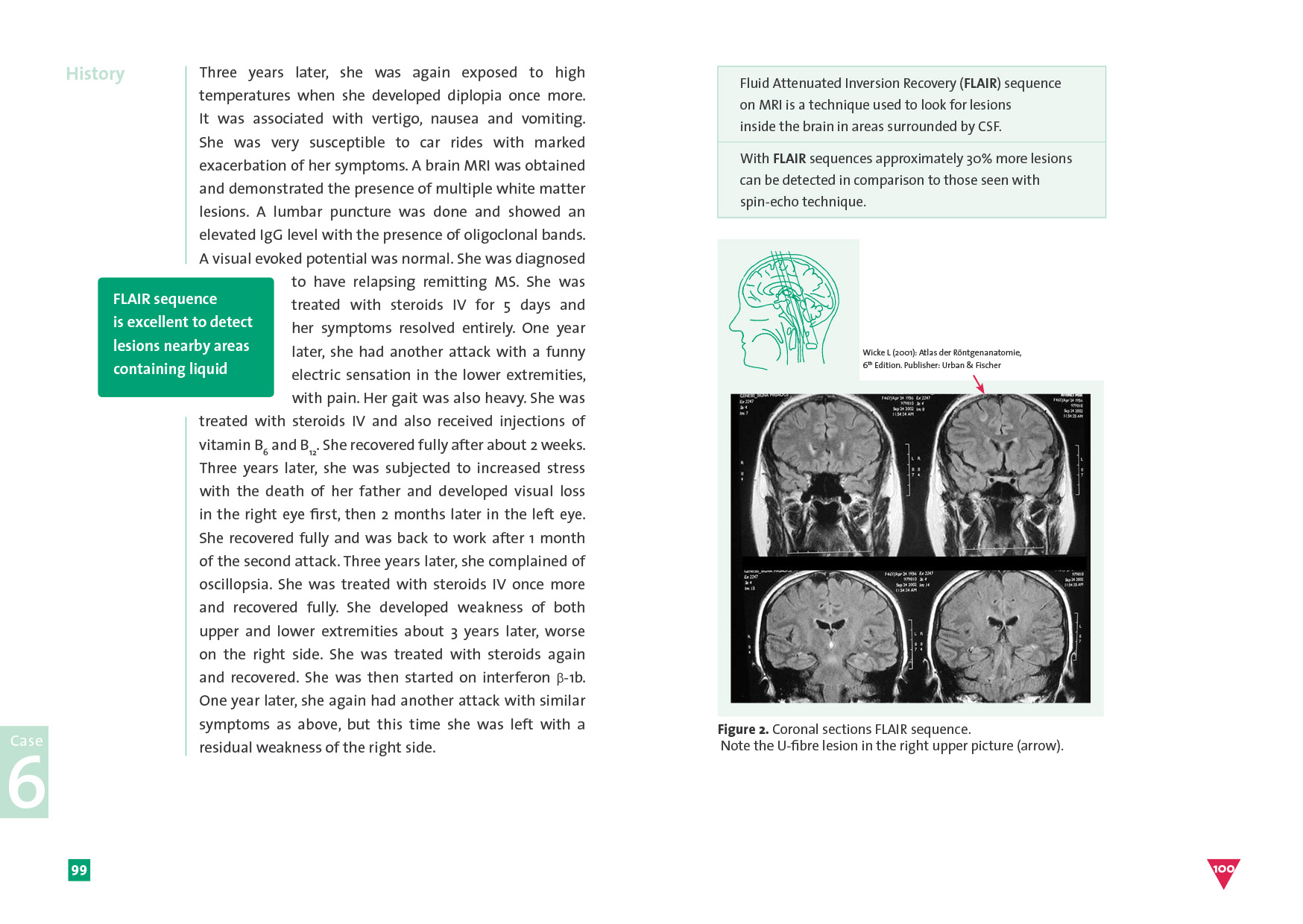 Buchpublikation – BrainLinc.