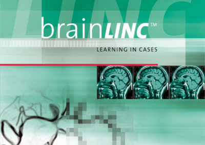 Biogen Idec | Buchpublikation – BrainLinc
